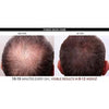 Machine repousse cheveux atoupry